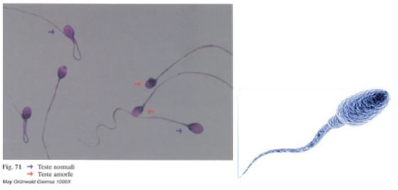 laboratorio-san-giorgio-test-analisi-esame-spermiogramma-spermatozoi-andrologia-1