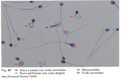 laboratorio-san-giorgio-test-analisi-esame-spermiogramma-spermatozoi-andrologia-2
