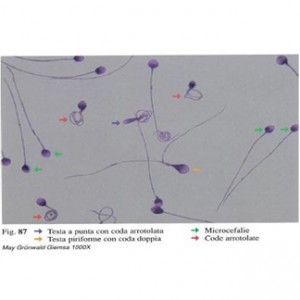 laboratorio-san-giorgio-test-analisi-esame-spermiogramma-spermatozoi-andrologia-4