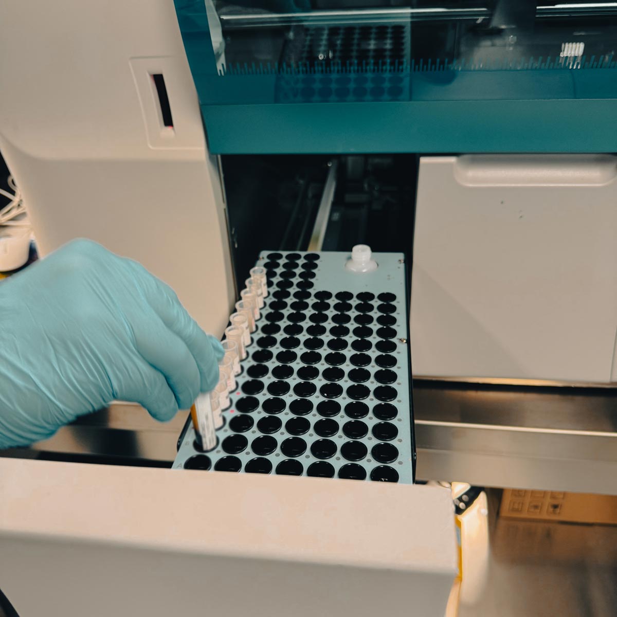 laboratorio-analisi-mediche-san-giorgio-pavia-san-genesio-uniti-milano-521